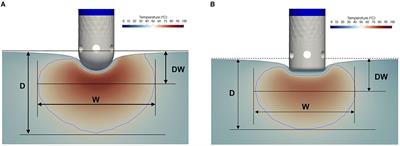 Systematic Characterization of High-Power Short-Duration Ablation: Insight From an Advanced Virtual Model